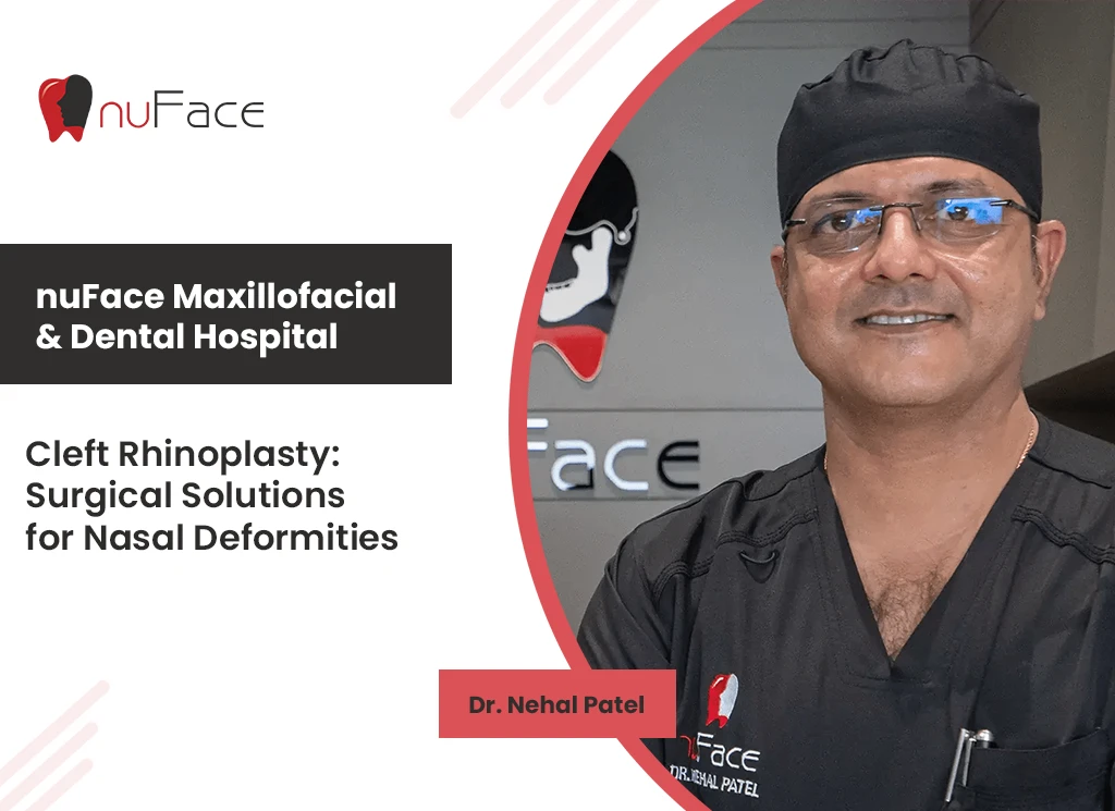 cleft rhinoplasty by best Maxillofacial surgeon in india