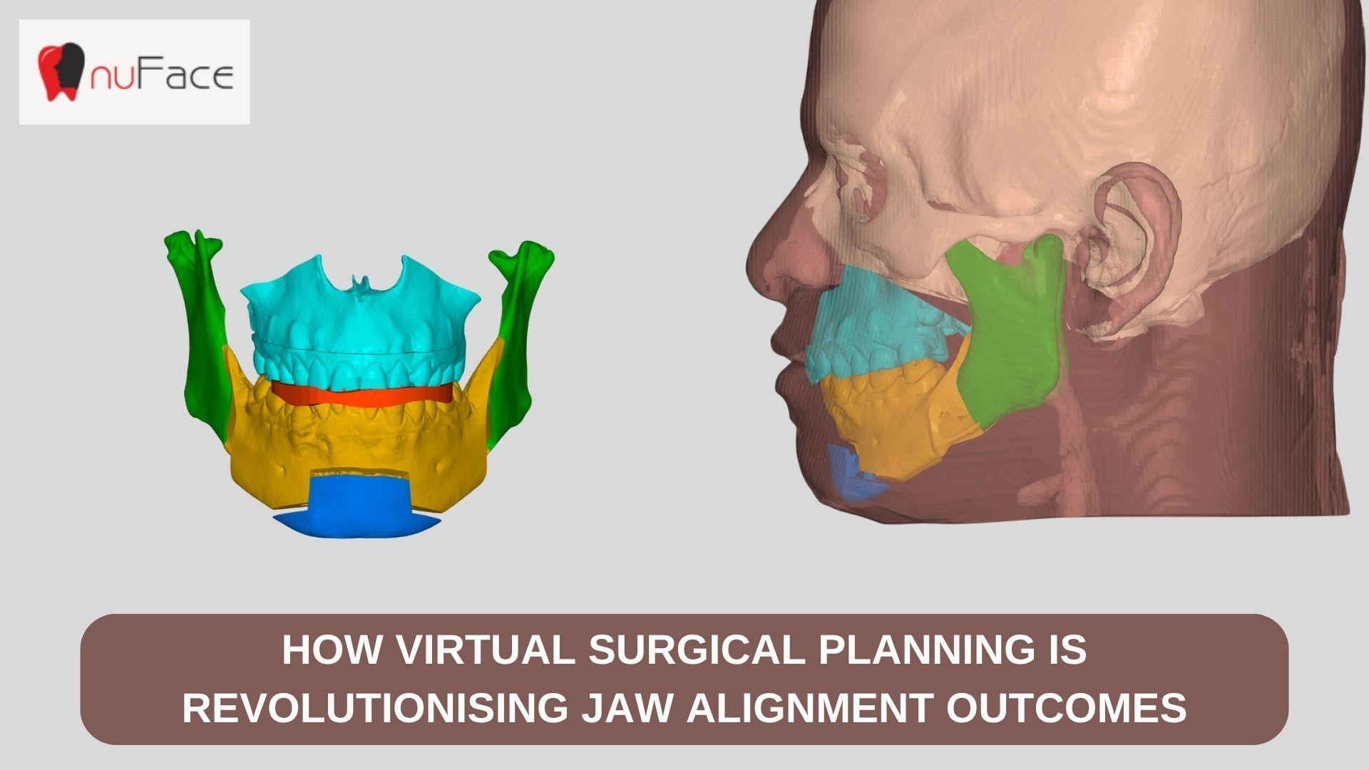 TMJ specialist in India