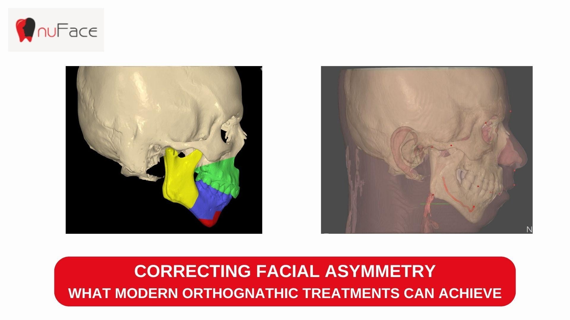 TMJ specialists in Indi