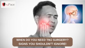 TMJ specialists in India