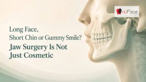 jaw surgery specialist in India.